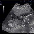 201310090945016